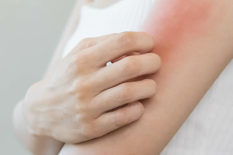 アレルギー検査、治療 画像