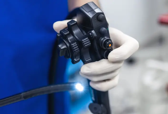 胃内視鏡検査 画像